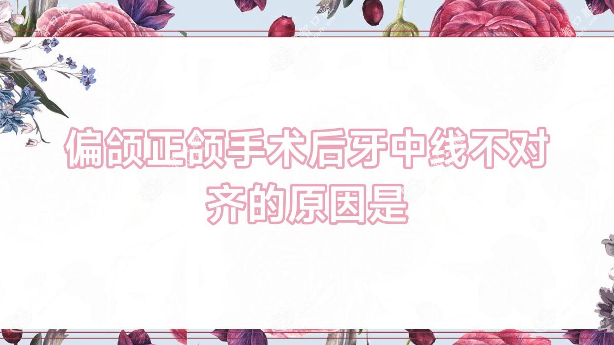 偏颌正颌手术后牙中线不对齐的原因是