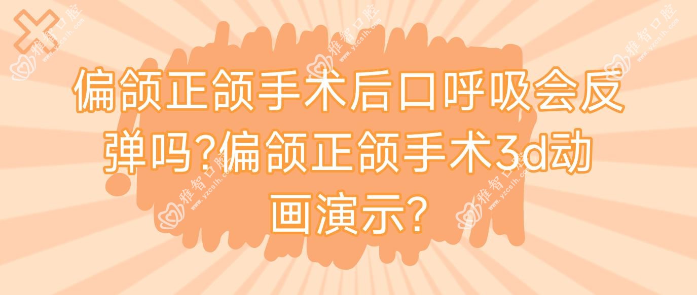 偏颌正颌手术后口呼吸会反弹吗?偏颌正颌手术3d动画演示?