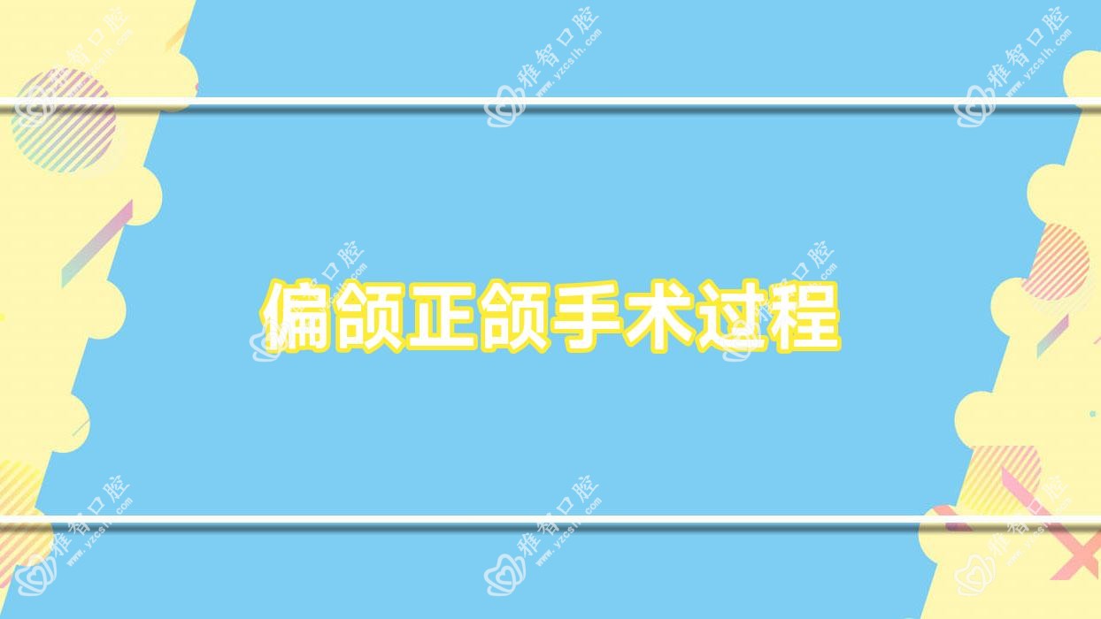 偏颌正颌手术过程