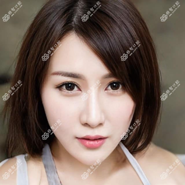 合肥全口种植牙价格多少钱?2025价目单:allon4全口种植牙10万元起、全口种植牙4万元起