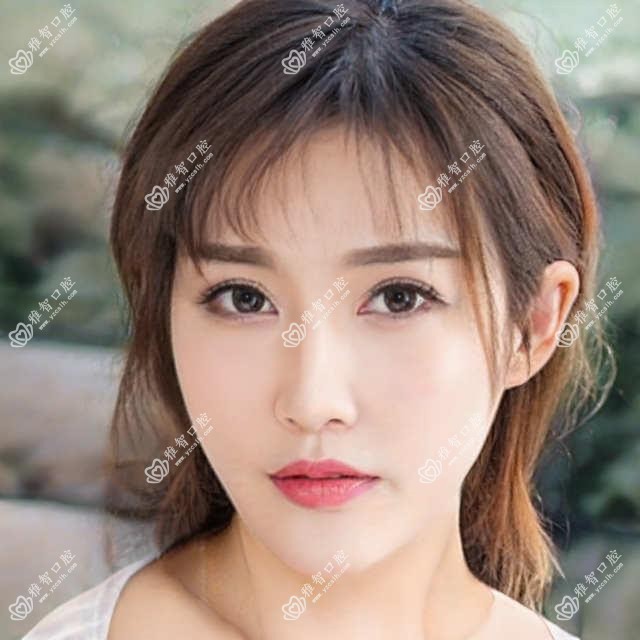 北京舌侧矫正器收费价格表2025（北京舌侧矫正器价格总览表）