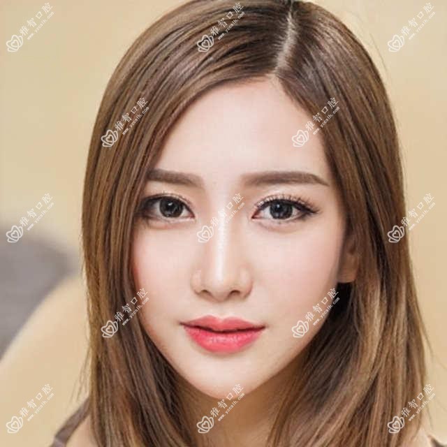 冷光美白怎么办?冷光美白相关治疗优缺点以及禁忌人群?