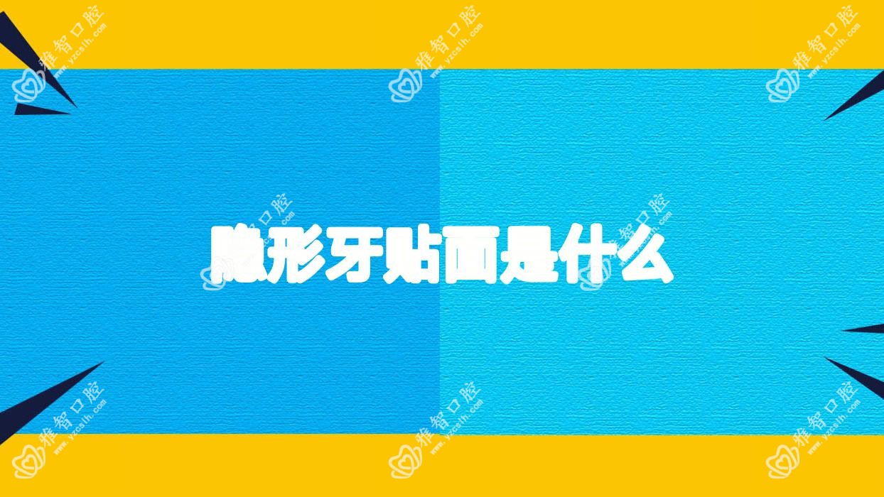 隐形牙贴面是什么
