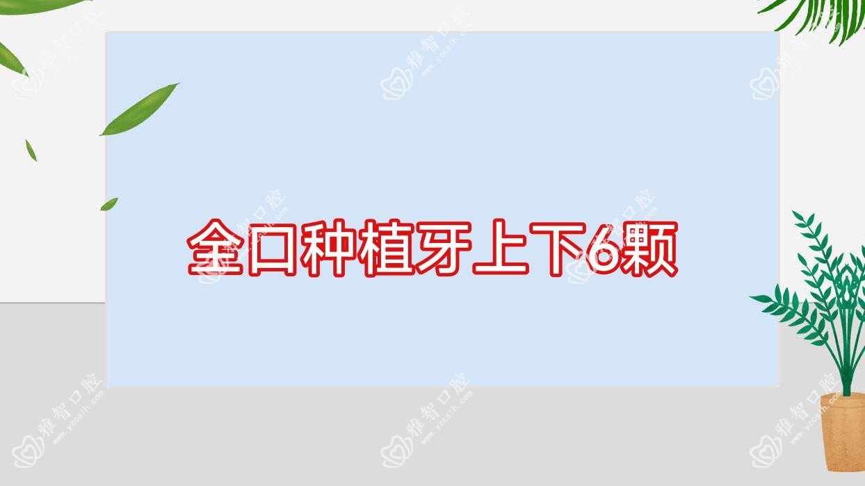 全口种植牙上下6颗