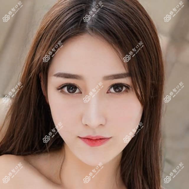 南通2025法国安多健种植牙收费表出炉!(含美国3I种植牙/ITI瑞锆种植牙费用收费表)