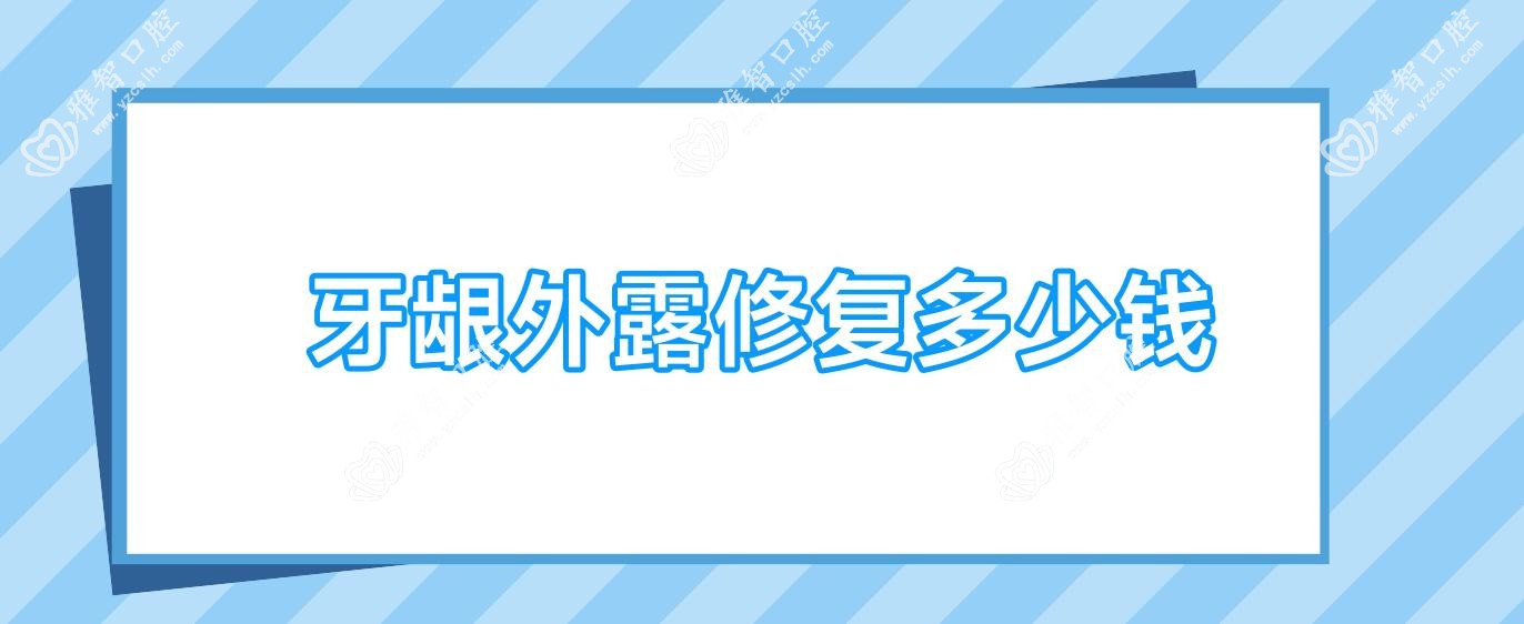 牙龈外露修复多少钱