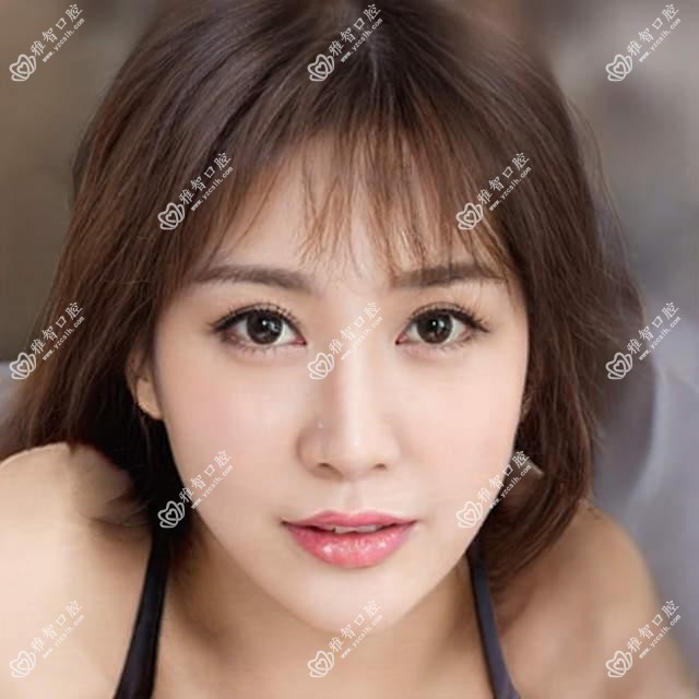 长春微创根管多少钱?长春虫牙/隐裂牙/牙齿外伤收费有性价比