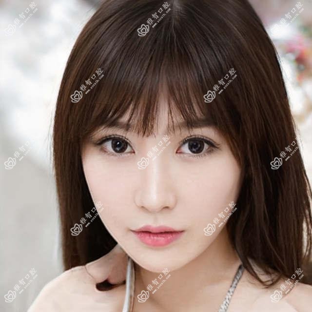 西安牙齿矫正收费表一览,想变好看的朋友能够参考