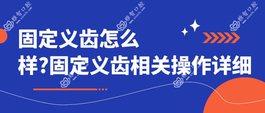 固定义齿怎么样?固定义齿相关操作详细介绍?
