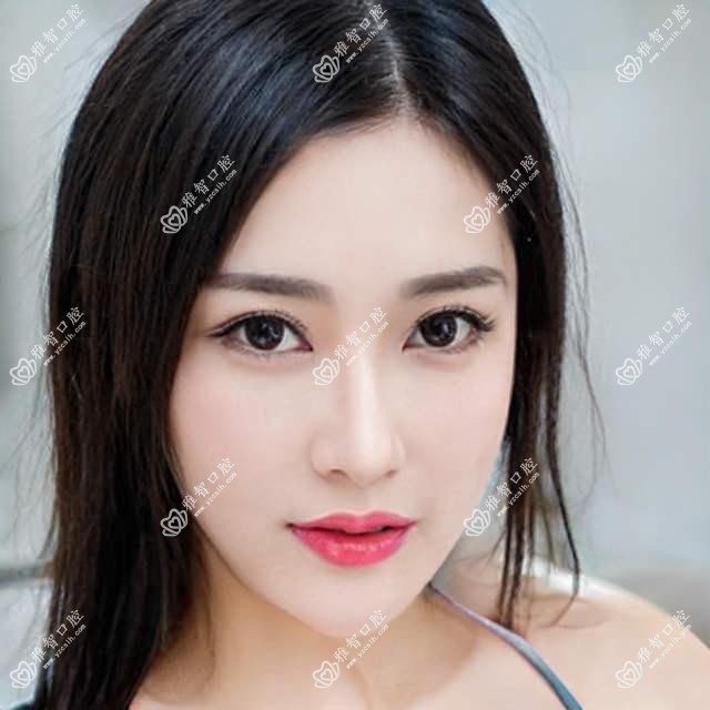 宁波做年龄阶段多少钱?抓紧看12-18岁牙齿矫正和成人牙齿矫正收费表