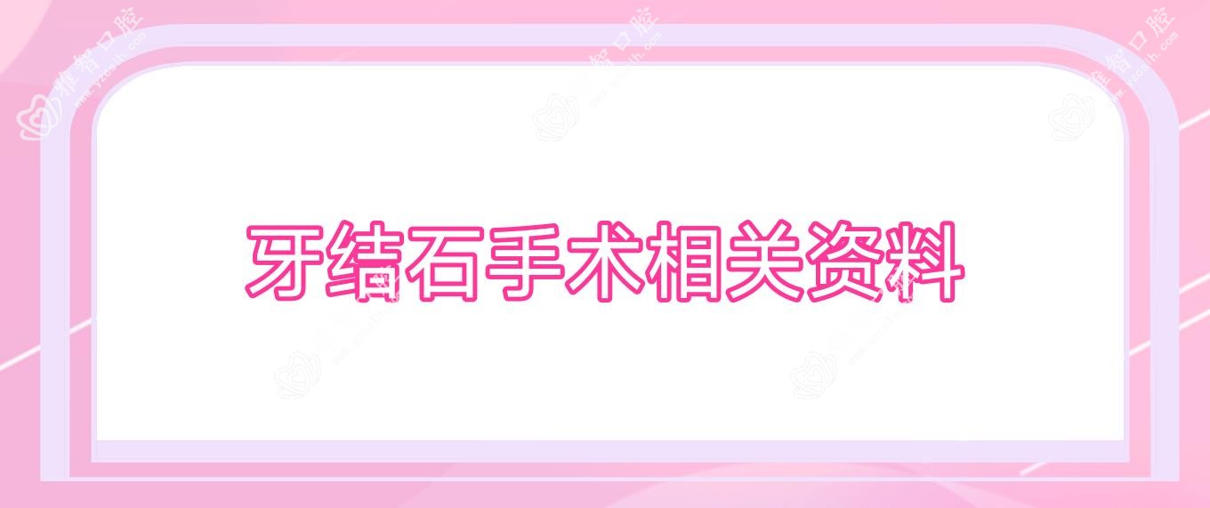 牙结石手术相关资料