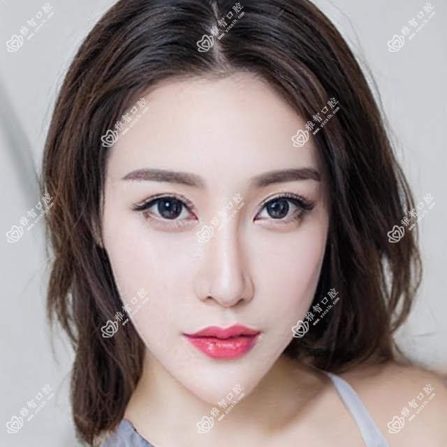中山牙齿脱落多少钱?2025年详细牙齿脱落价格表
