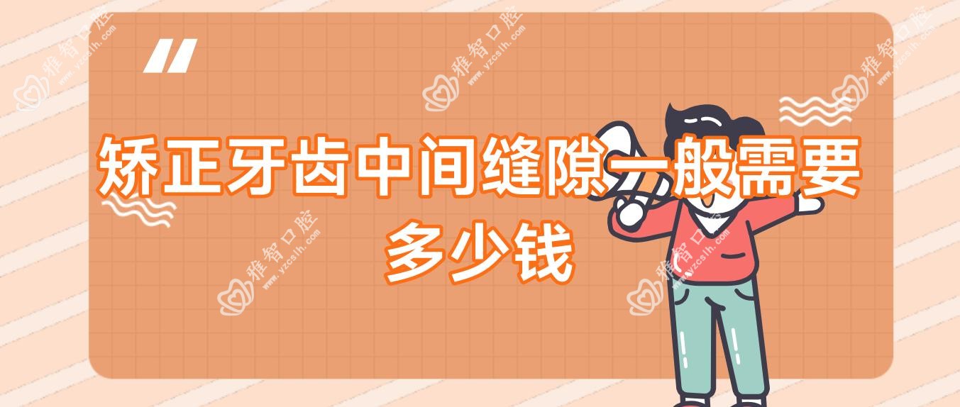 矫正牙齿中间缝隙一般需要多少钱