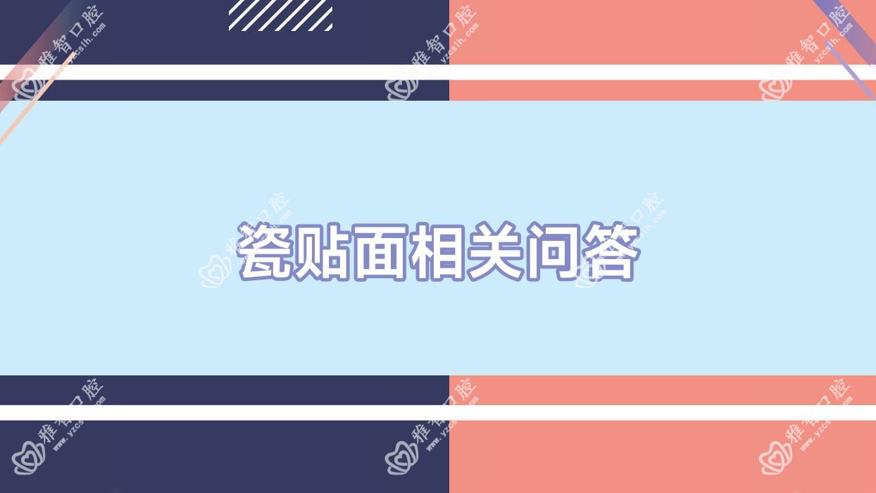 瓷贴面相关问答