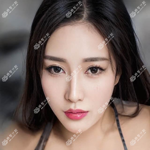 重庆皓齿美白是多少?重庆超声波洗牙/牙黄变白/咖啡牙美白费用低