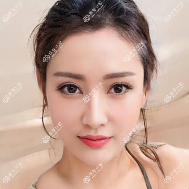 重庆德国费亚丹种植牙收费表2025年新版更新,含瑞士ITI种植牙/德国贝格种植牙/德国ICX种植牙收费明细