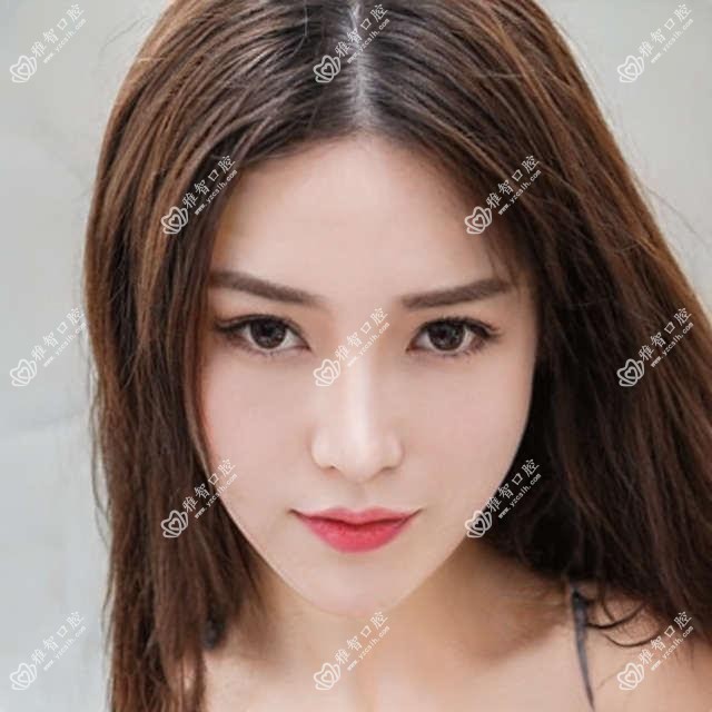 时代天使怎么治疗 时代天使治疗方案推荐