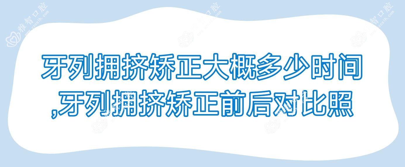 牙列拥挤矫正大概多少时间,牙列拥挤矫正前后对比照