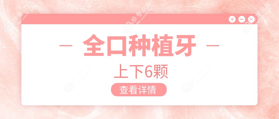 全口种植牙上下6颗