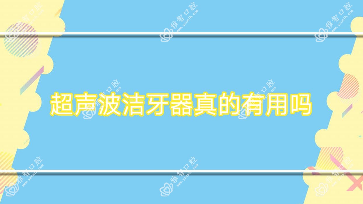 超声波洁牙器真的有用吗