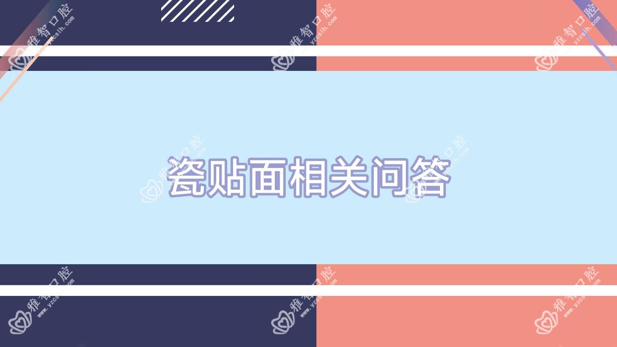 瓷贴面相关问答