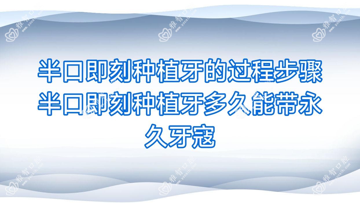 半口即刻种植牙的过程步骤 半口即刻种植牙多久能带持久牙寇