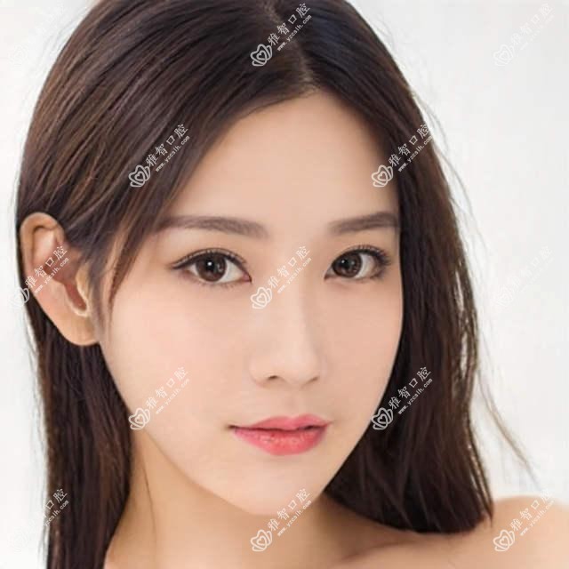长春深覆盖正颌手术价目单:长春深覆盖正颌手术市场均价及各医院报价参考