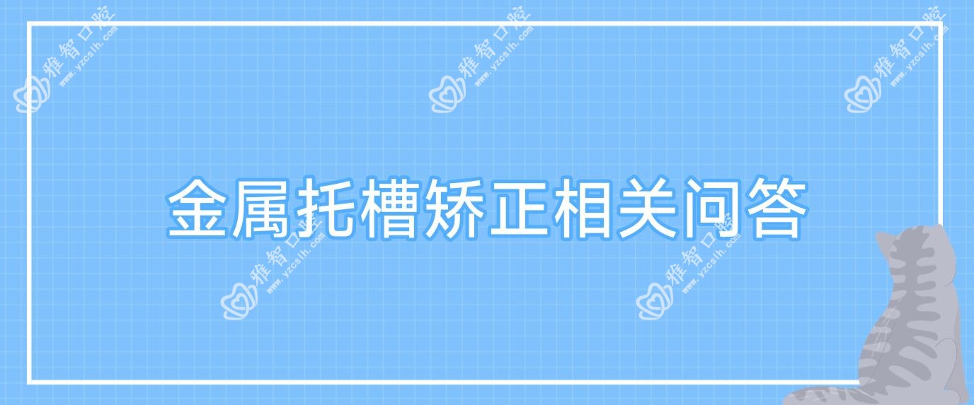 金属托槽矫正相关问答