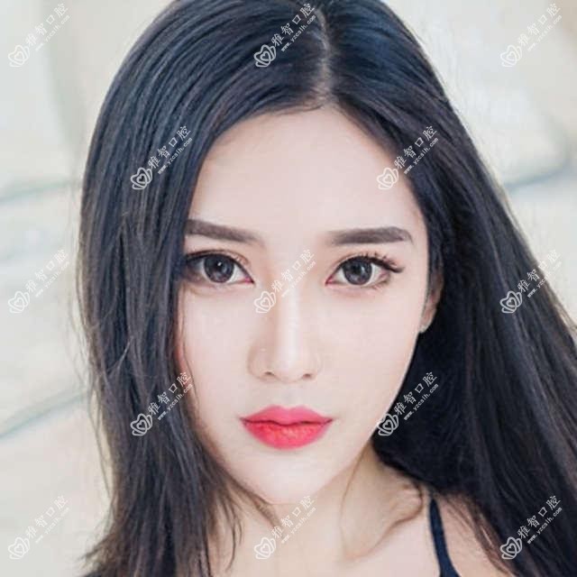 泉州活动假牙贵不贵?本地推荐医院展示