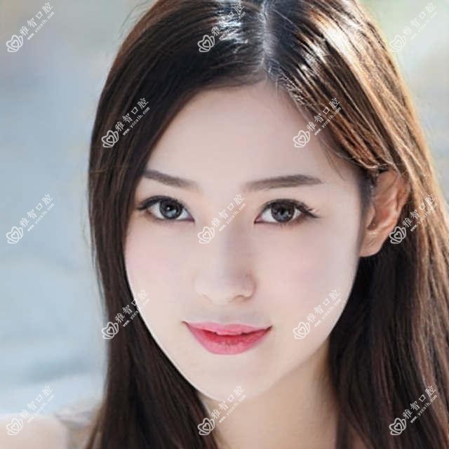 成都半口即刻负重种植牙收费2025年新详细揭秘-忠科口腔(成华店)/圣贝牙科(龙腾店)半口即刻负重种植牙价格表(收费)