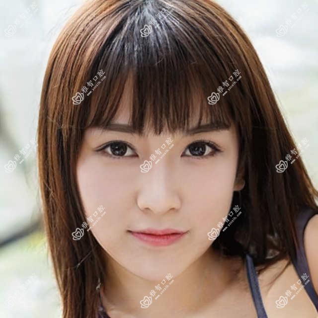 沈阳前突牙价格2025年新详尽公开-沈阳沈河艾丽莉口腔/辽宁省金秋医院口腔科前突牙价格表(费用)
