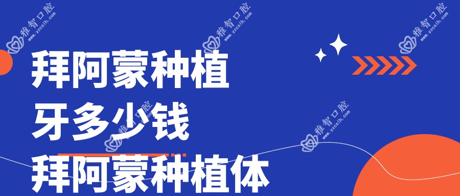 拜阿蒙种植牙多少钱 拜阿蒙种植体