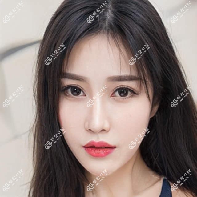 青岛深覆颌排名榜及费用介绍!价格也不贵的医院是那家呢?