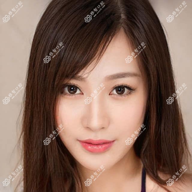南宁牙齿脱落收费表(费用)-南宁牙齿脱落便宜花多少钱