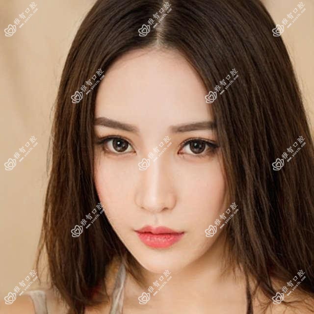 珠海舌侧矫正价目单一览,想变好看的小伙伴可以参照