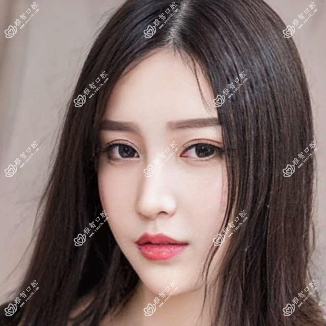 深圳龙华区医院烤瓷牙多少钱?烤瓷牙2359元