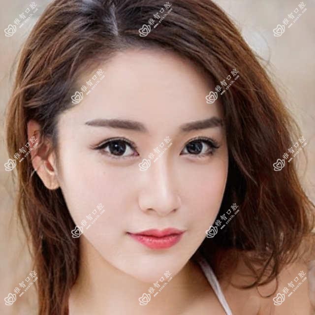东莞牙齿龋坏多少钱?2025价格表揭秘了~东莞牙齿龋坏费用标准抓紧看!