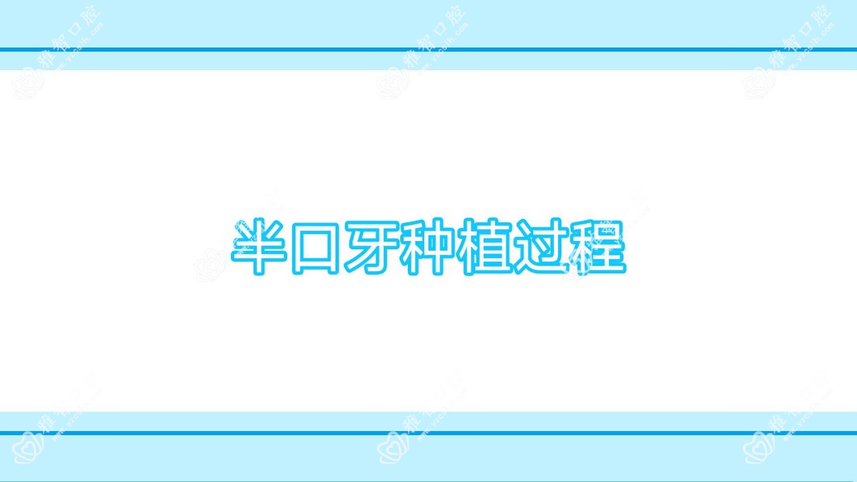 半口牙种植过程