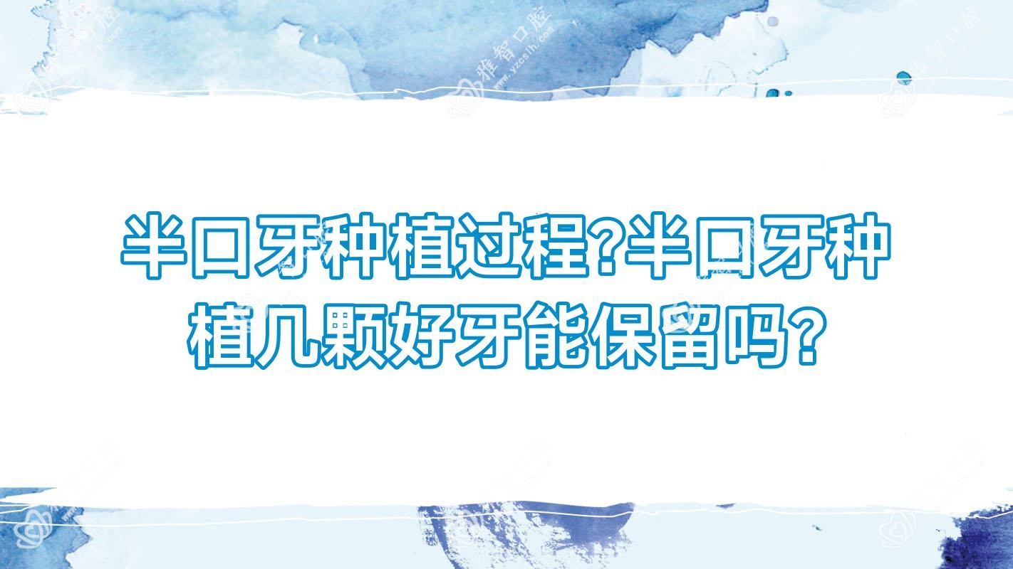 半口牙种植过程?半口牙种植几颗好牙能保留吗?
