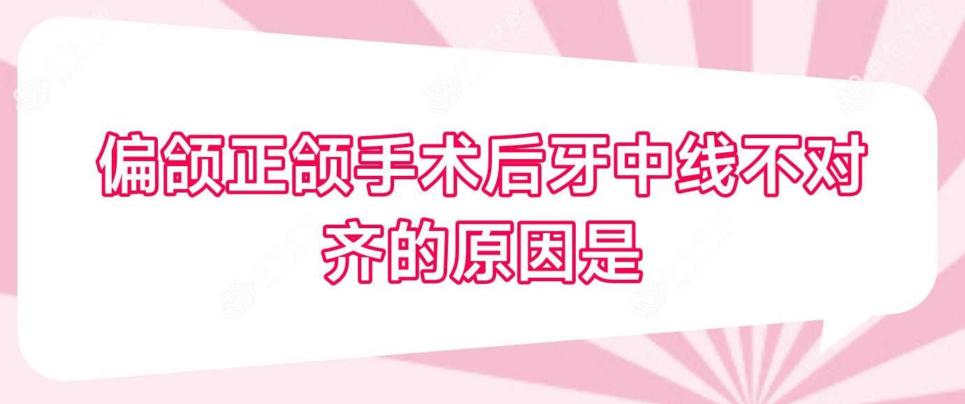 偏颌正颌手术后牙中线不对齐的原因是