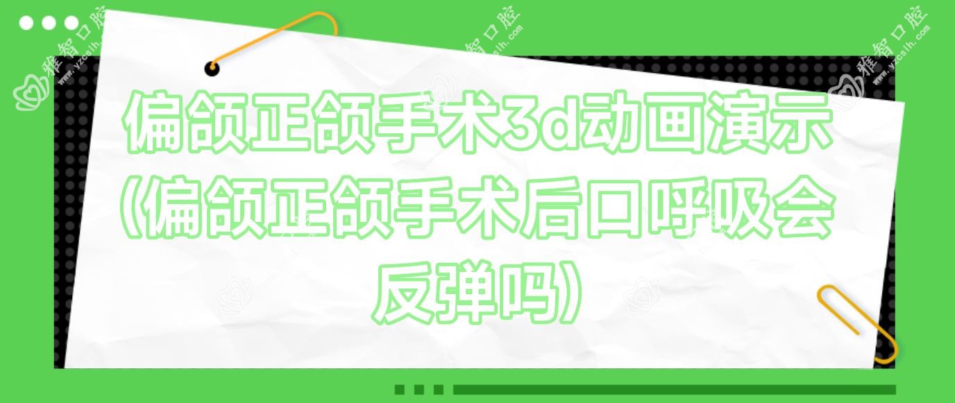 偏颌正颌手术3d动画演示(偏颌正颌手术后口呼吸会反弹吗)