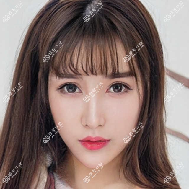 惠州中龋费用明细2025新版,惠州中龋/蛀牙多少钱