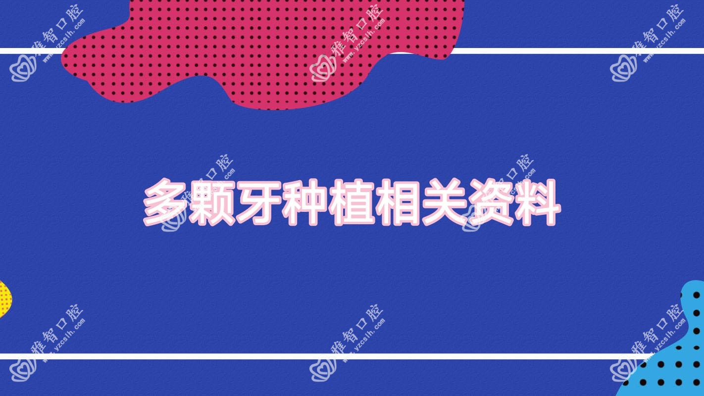 多颗牙种植相关资料