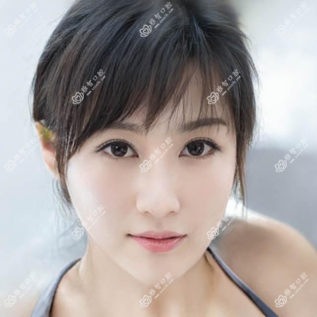 南通海门市医院地包天牙齿矫正多少钱?地包天牙齿矫正6799元