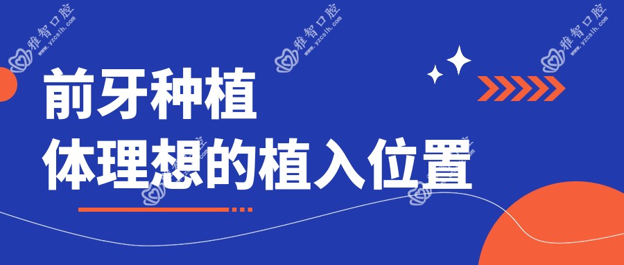 前牙种植体理想的植入位置