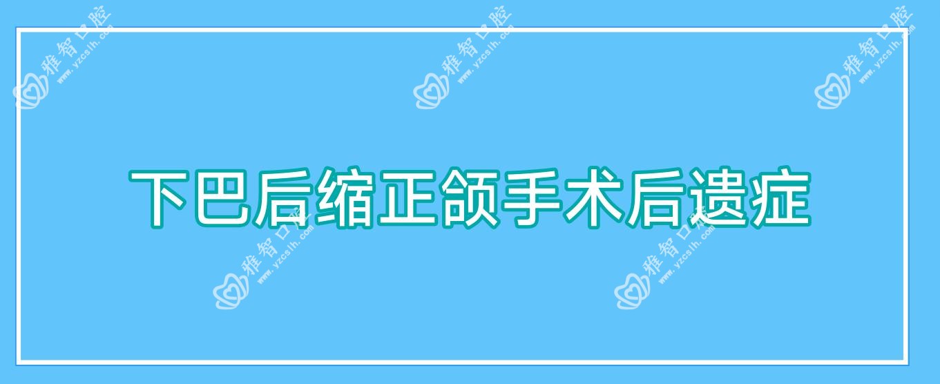 下巴后缩正颌手术后遗症