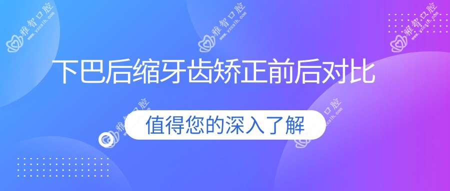 下巴后缩牙齿矫正前后对比
