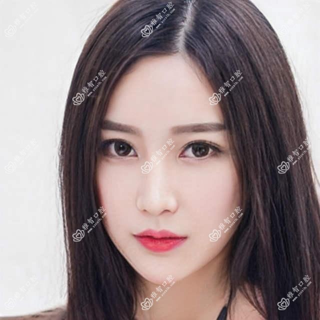 牙齿漂白的项目百科 牙齿漂白手术疼吗?以及恢复时间介绍