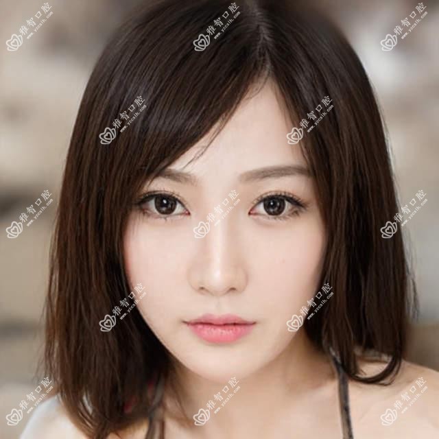 惠州惠阳区医院瓷贴面多少钱?瓷贴面850元
