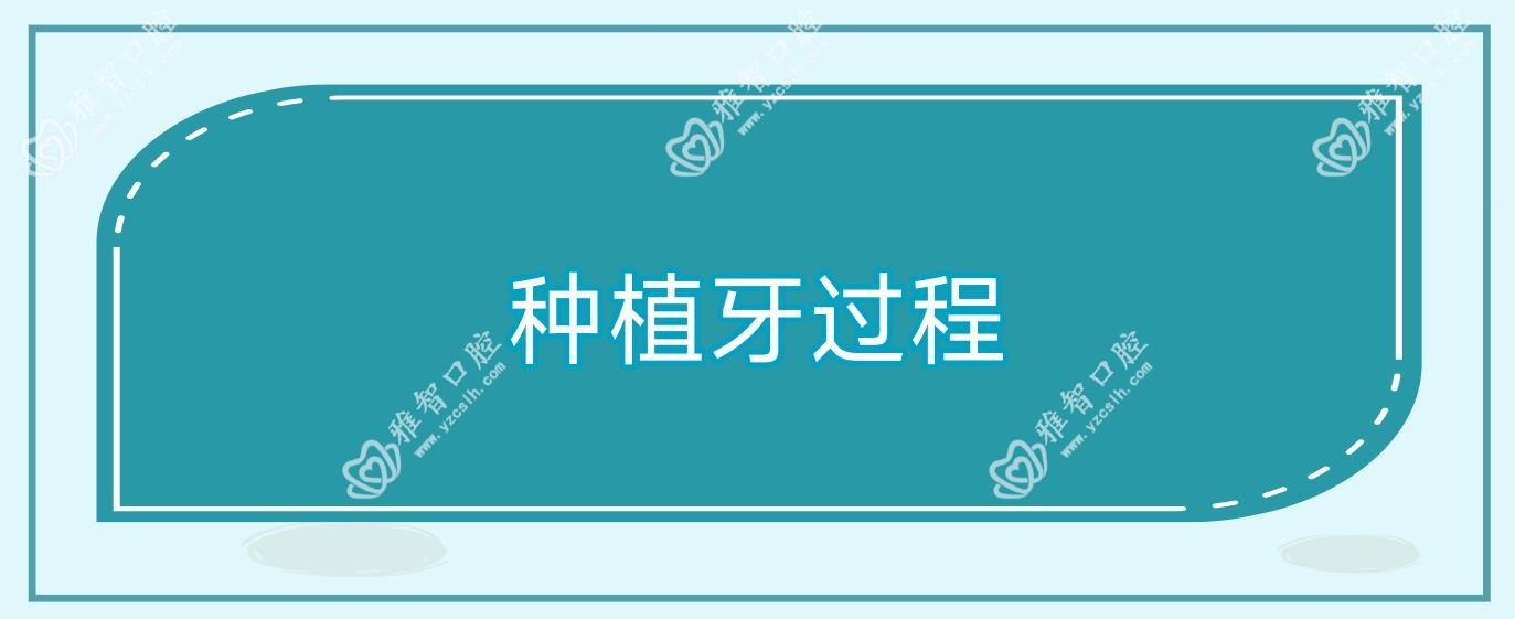 种植牙过程